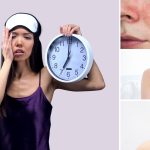 7 Tips Pola Hidup Sehat untuk Kulit Bebas Jerawat