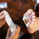 7 Cara Mengatasi Luka Ringan di Kaki agar Cepat Sembuh