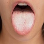 7 Cara Atasi Lidah Terasa Asam atau Aneh