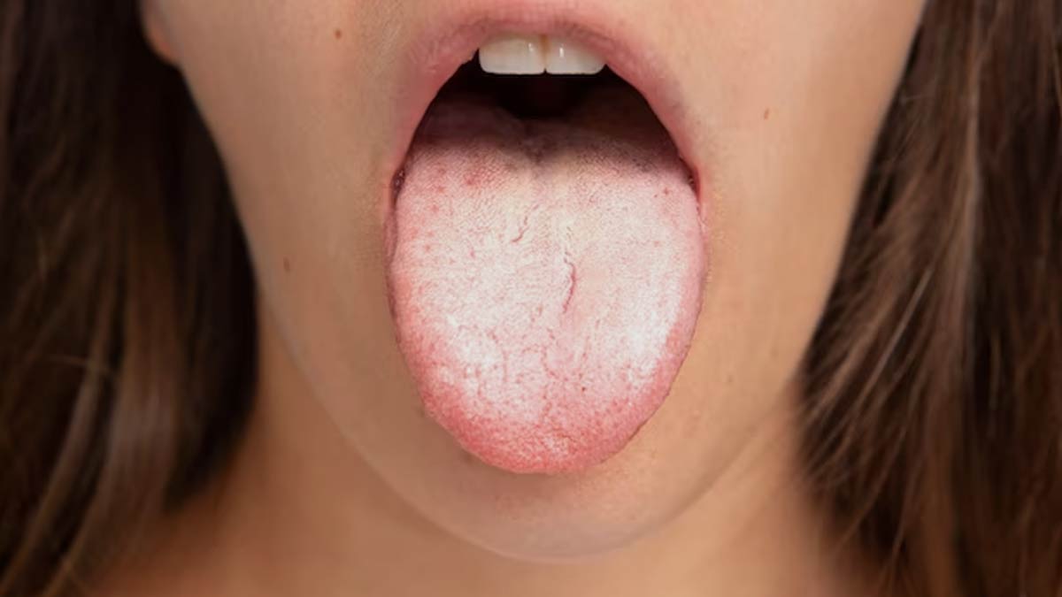 7 Cara Atasi Lidah Terasa Asam atau Aneh