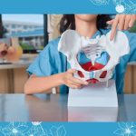 10 Cara Bantu Proses Pemulihan Panggul Setelah Cidera