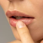 5 Cara Mendeteksi Masalah Kesehatan dari Warna Bibir