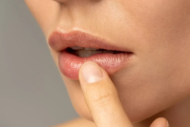 5 Cara Mendeteksi Masalah Kesehatan dari Warna Bibir