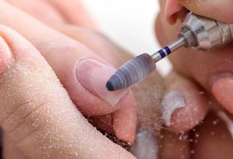 7 Hal yang Wajib Dilakukan Setelah Melepas Akrilik Kuku