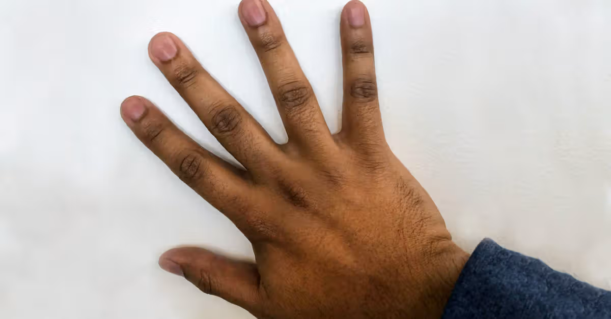 7 Cara Mengembalikan Warna Kulit Tangan yang Gelap karena Matahari