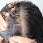 7 Cara Mengurangi Rambut Berminyak Secara Alami