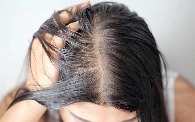 7 Cara Mengurangi Rambut Berminyak Secara Alami
