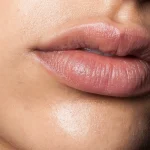5 Cara Membedakan Bibir Kering Biasa dan Masalah Kulit Serius