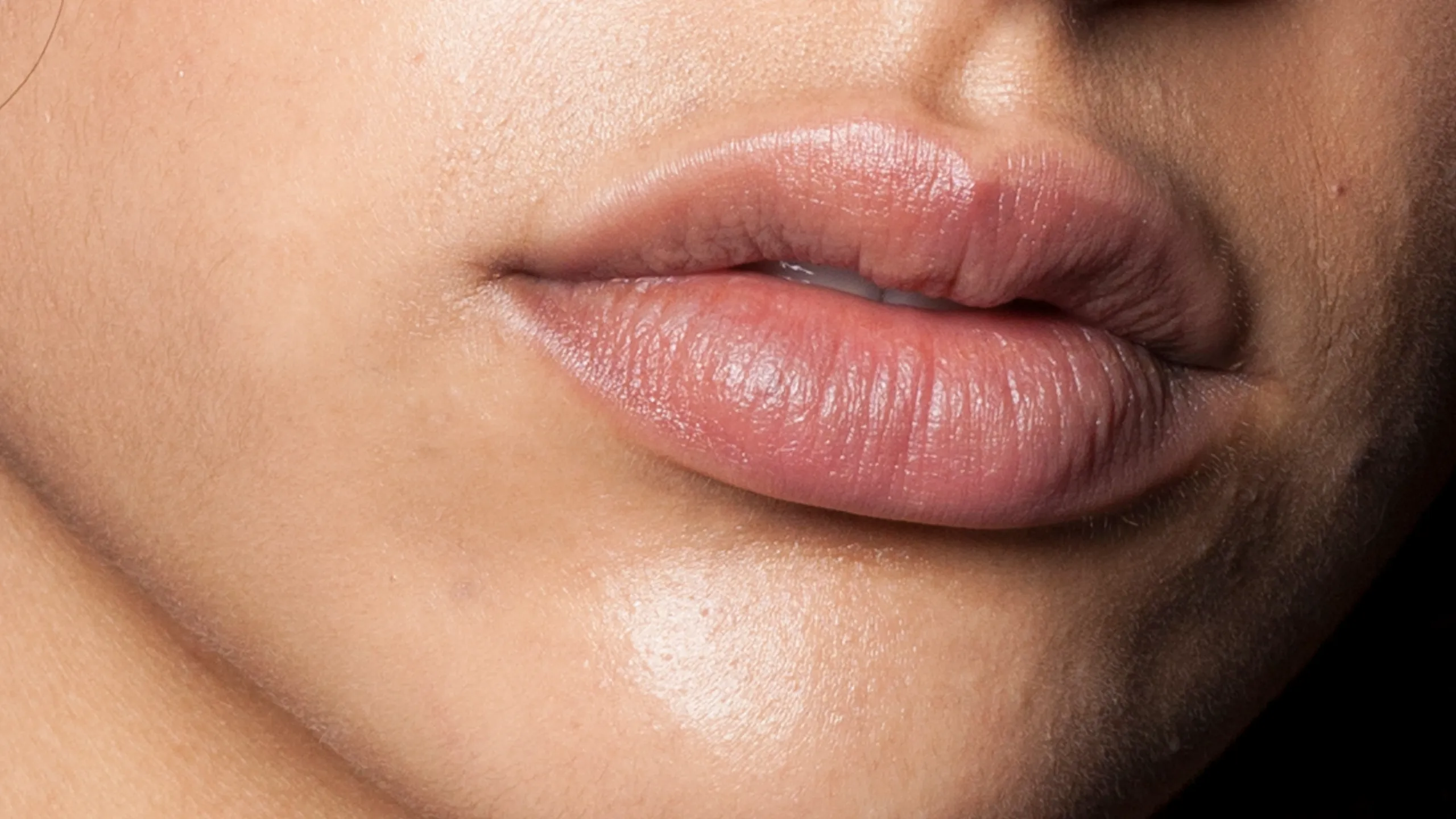 5 Cara Membedakan Bibir Kering Biasa dan Masalah Kulit Serius