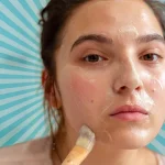 10 Tips Merawat Kulit Sensitif dan Berjerawat